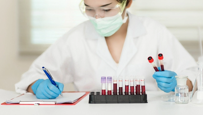 female doctor taking notes on blood samples