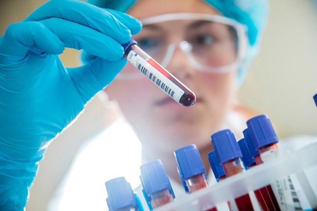 female holds blood sample from rack