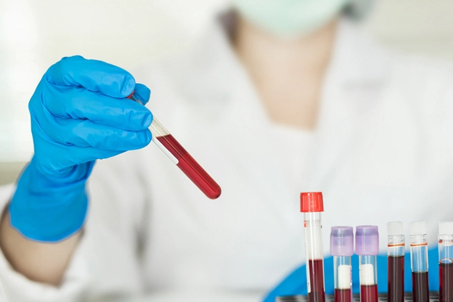 female technician holding blood tube test a rack of blood samples tubes of patients in laboratory in the hospital