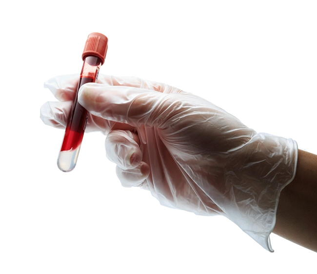 hand with glove holding blood in test tube and tubes test