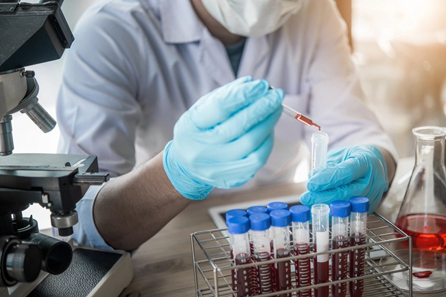 lab technician assistant analyzing a blood sample in test tube at laboratory