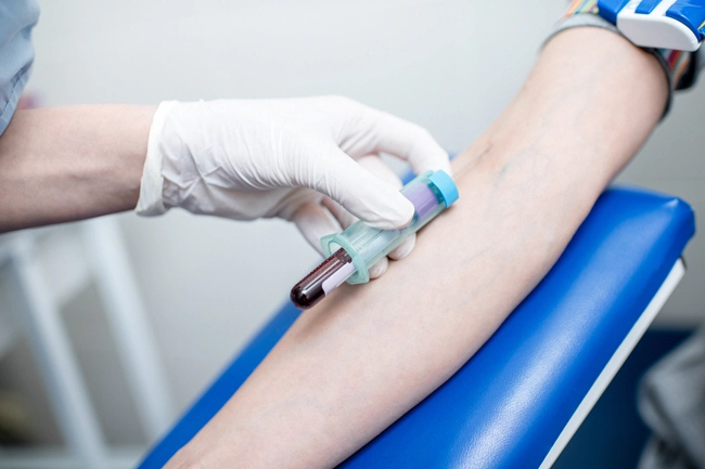 laboratory assistant taking blood with vacuum capsule for test