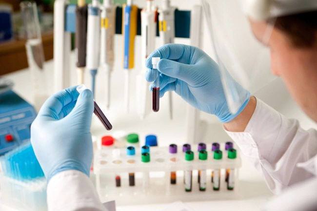 laboratory scientist looking at test tubes with blood and analysis