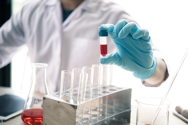 male doctor examines small blood sample