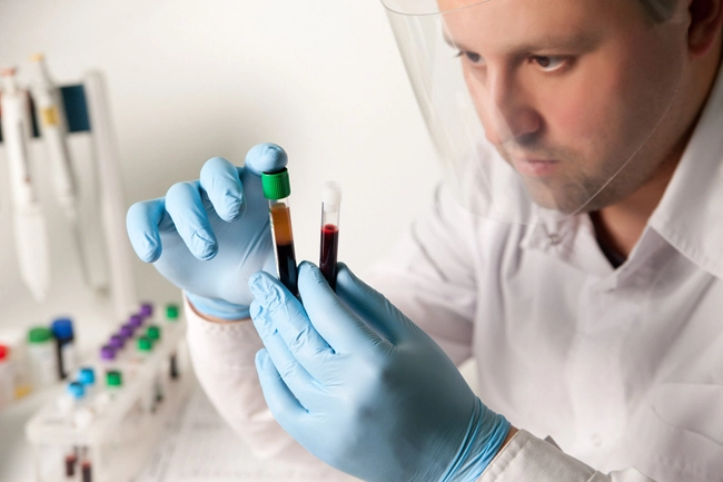 male doctor examines two blood samples