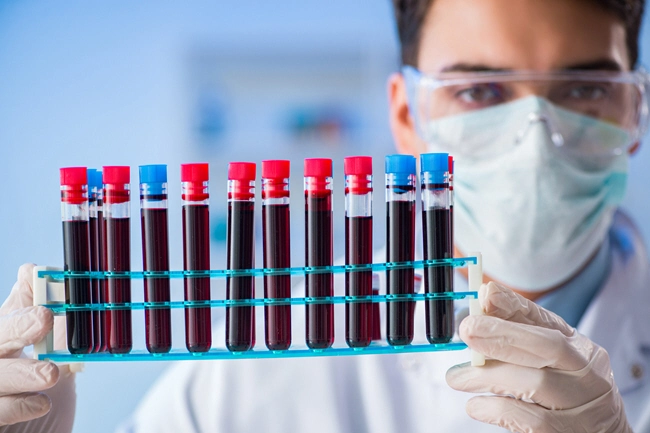 male doctor holding a rack of blood male doctor holding a rack of blood