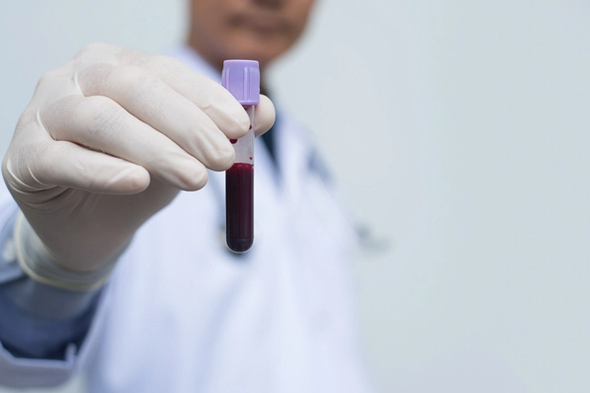 male doctor or technician holding red blood whole blood in test tube for the sample