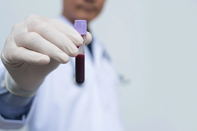 male doctor or technician holding red blood whole blood in test tube for the sample male doctor or technician holding red blood whole blood in test tube for the sample
