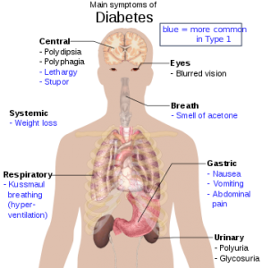 Main_symptoms_of_diabetes