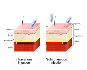 Subq injection angle 300x242